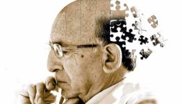 للزهايمر