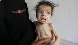 أطفال اليمن  والموت جوعاً