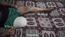 احد الفلسطينيين مبتور القدم جراء استهداف القناص الاسرائيلي