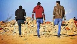 مبتورو الساق