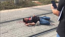 الطفل أحمد مناصرة بعد إصابته برصاص العدو