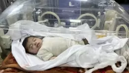 اطفال  خدج