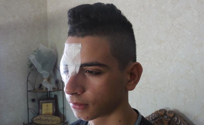 طفل فلسطيني يفقد عينه اليمنى جراء اطلاق نار
