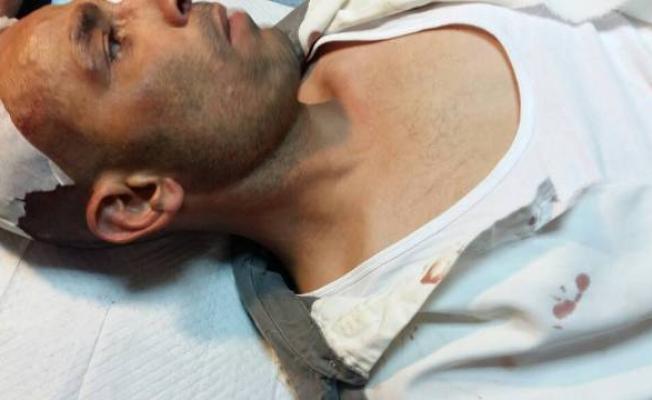 المصاب رع أبو الدهب