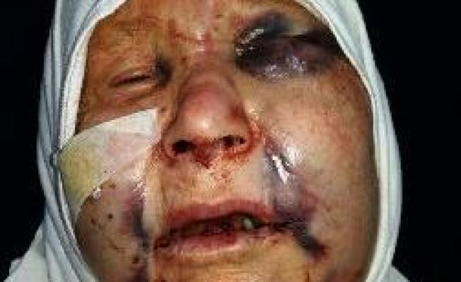 اصابة المسنة  في البارد