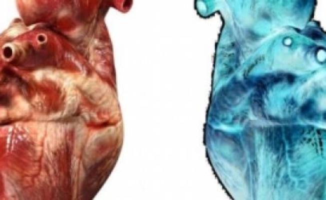 قلب رقمي لمساعدة مرضى القلب