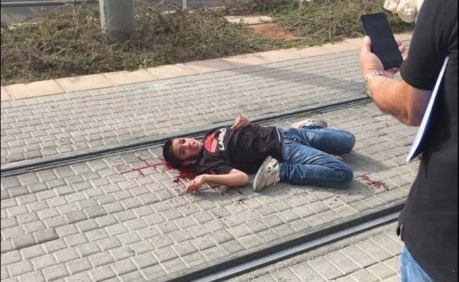 الطفل أحمد مناصرة بعد إصابته برصاص العدو