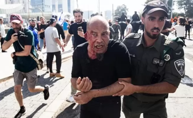 المواجهة بين الشرطة الاحتلالية والمعارضين
