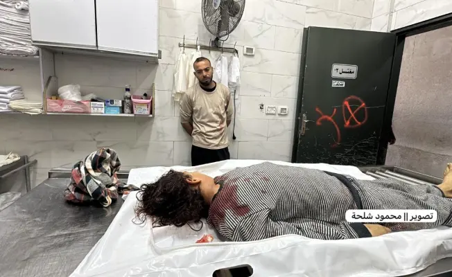 استشهاد طفلة