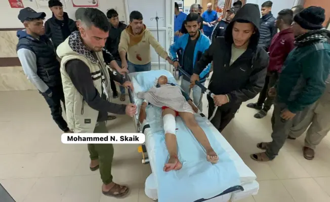 إصابة طفلين