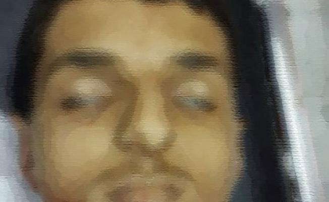 جرى تمويه صورة الشاب