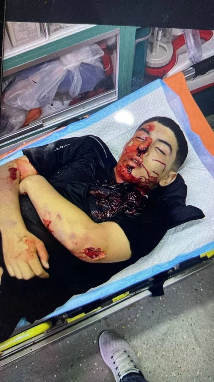 الفتى عمرو قبها 1